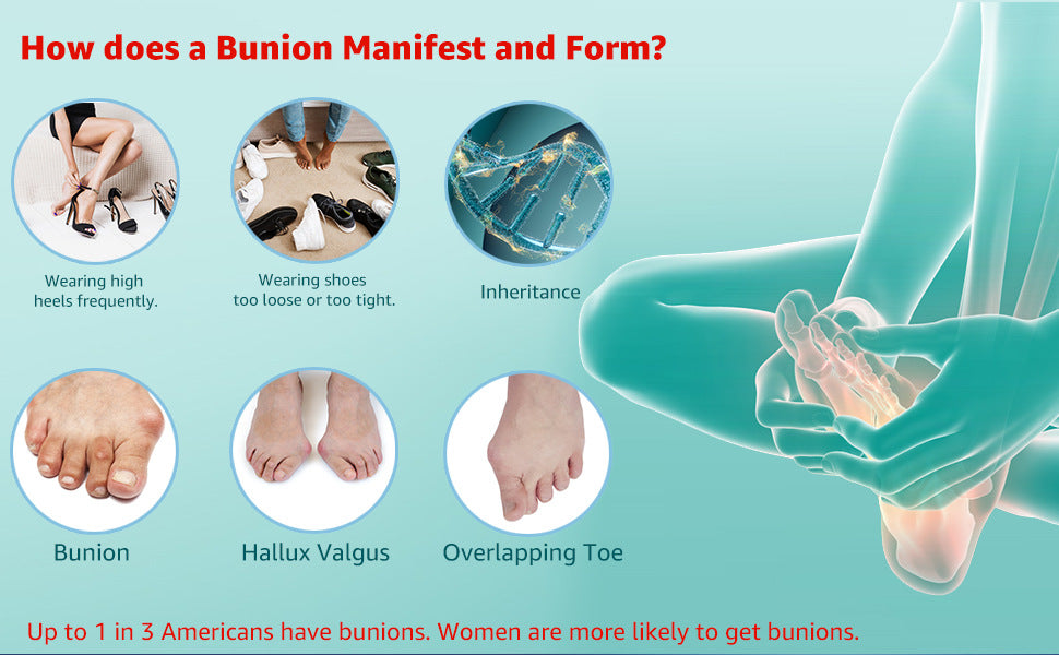 Enhanced Version Foot Protector SEBs Hallux Valgus Brace Female Day and Night Use Large Toe Cover Male Toe Separator Sole Cover